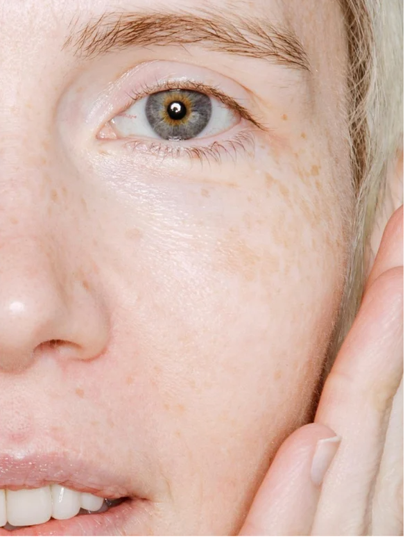 Close-up of a person with healthy skin showcasing the benefits of Microbiome Prebiotics Face Mist for hydration.