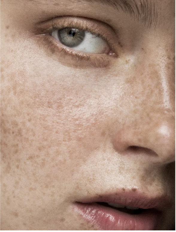 Close-up of a model's face showing natural skin texture, highlighting freckles and radiance for Pigment Perfecting Serum for All Skin.