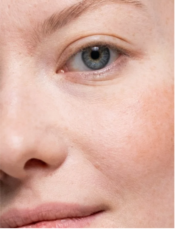 Close-up of a woman's face showcasing smooth skin, highlighting the effects of Retinol Alternative Serum For All Skin.