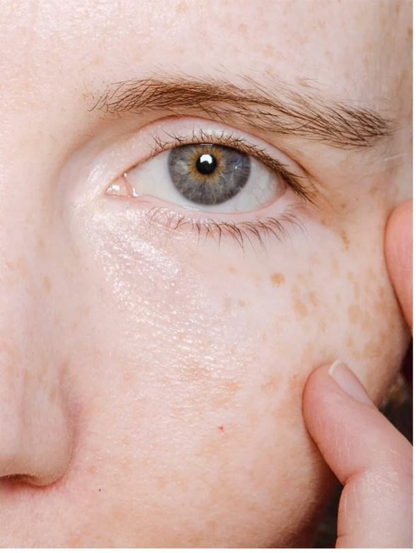 Natural retinol alternative eye serum applied to smooth fine lines under the eye, enhancing delicate skin texture.