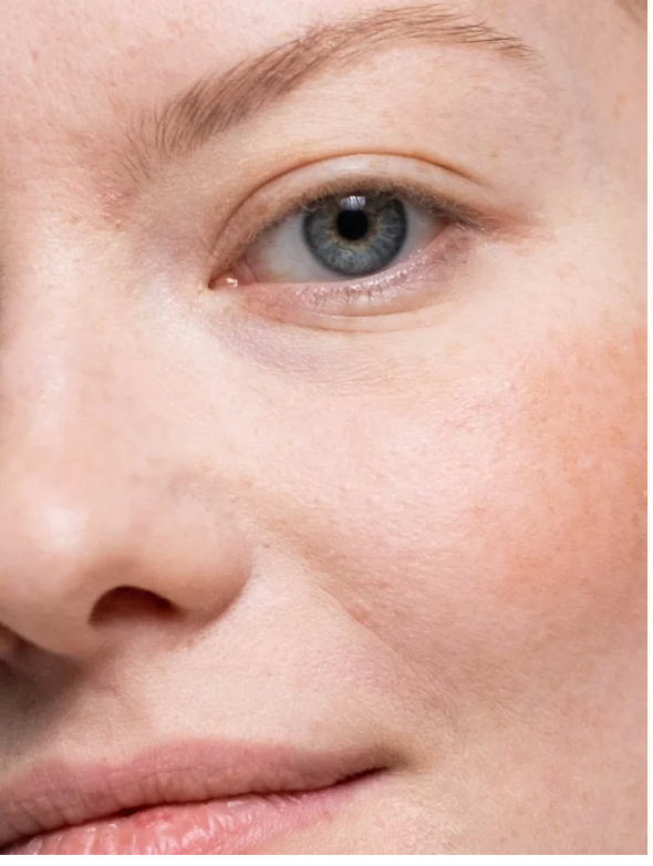 Close-up of a face showcasing clear skin using Collagen Boost Serum for All Skin for a youthful glow.